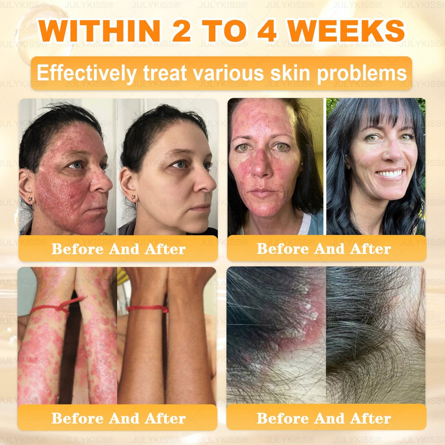 🎁 𝑱𝑼𝑳𝒀𝑲𝑰𝑺𝑺®  has a surprise upgrade just for you! You've already got an amazing offer but now you've unlocked an even better one:You'll get a massive 50% off your next purchase - for the next two minutes only!🎁