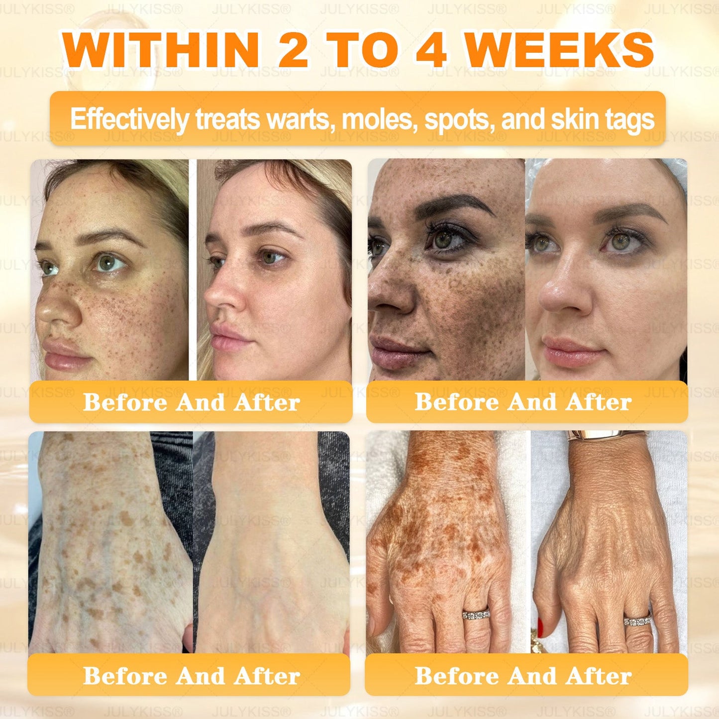 🎁 𝑱𝑼𝑳𝒀𝑲𝑰𝑺𝑺®  has a surprise upgrade just for you! You've already got an amazing offer but now you've unlocked an even better one:You'll get a massive 50% off your next purchase - for the next two minutes only!🎁